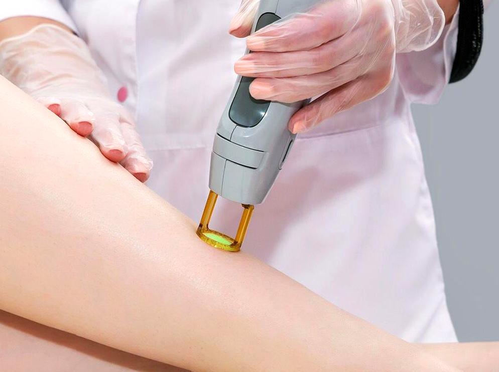 Laser Hair Removal: Scientific Insights and Practical Applications