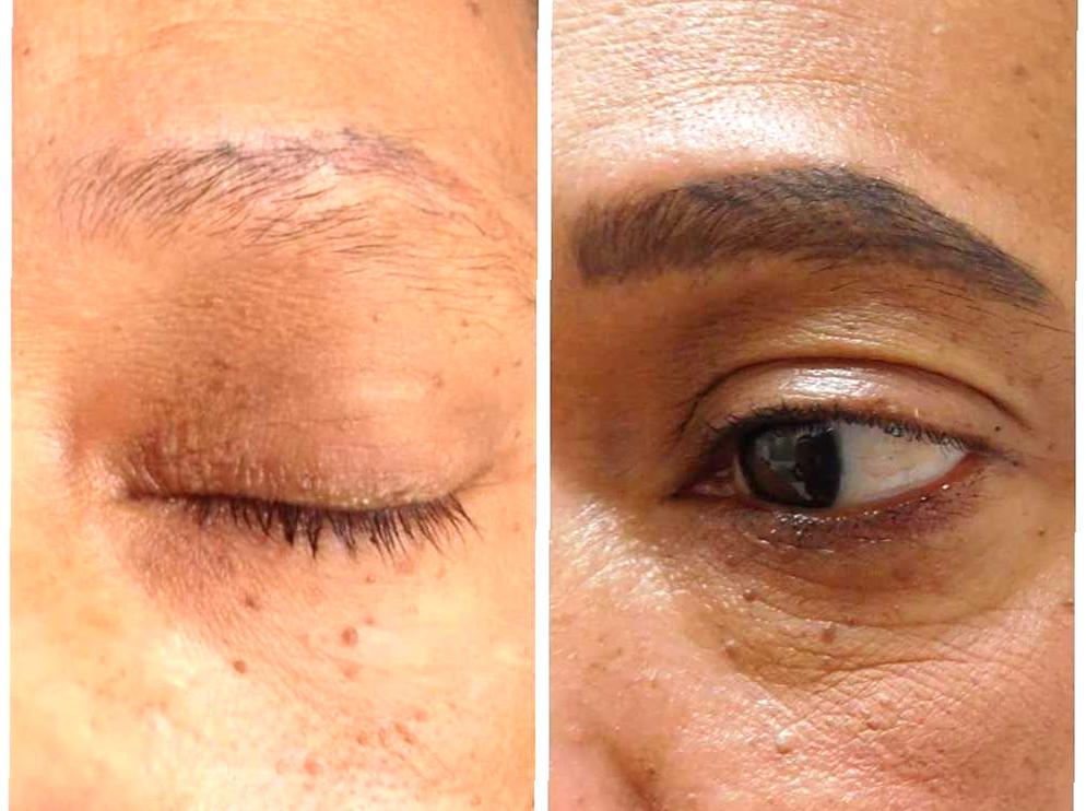 Managing Microblading Results on Oily Skin
