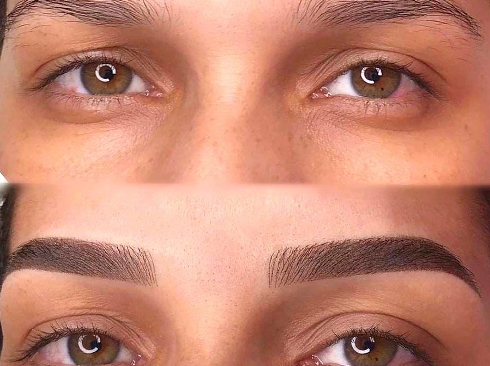 Essential Aftercare for Oily Skin Following Microblading