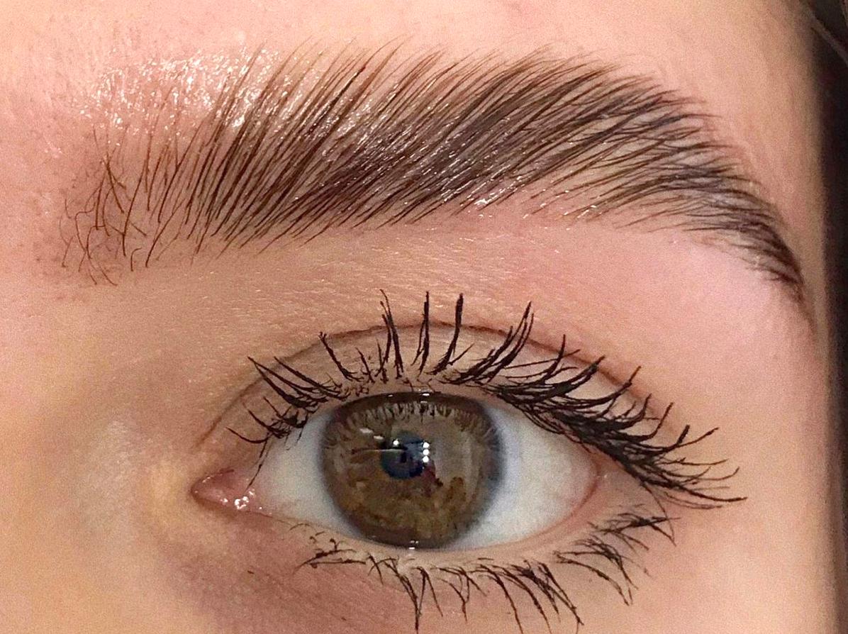 Adverse Effects Linked to Microblading