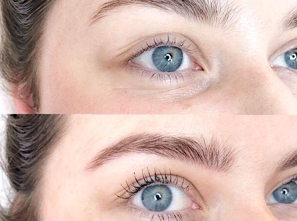 Side Effects Associated with Eyebrow Microblading