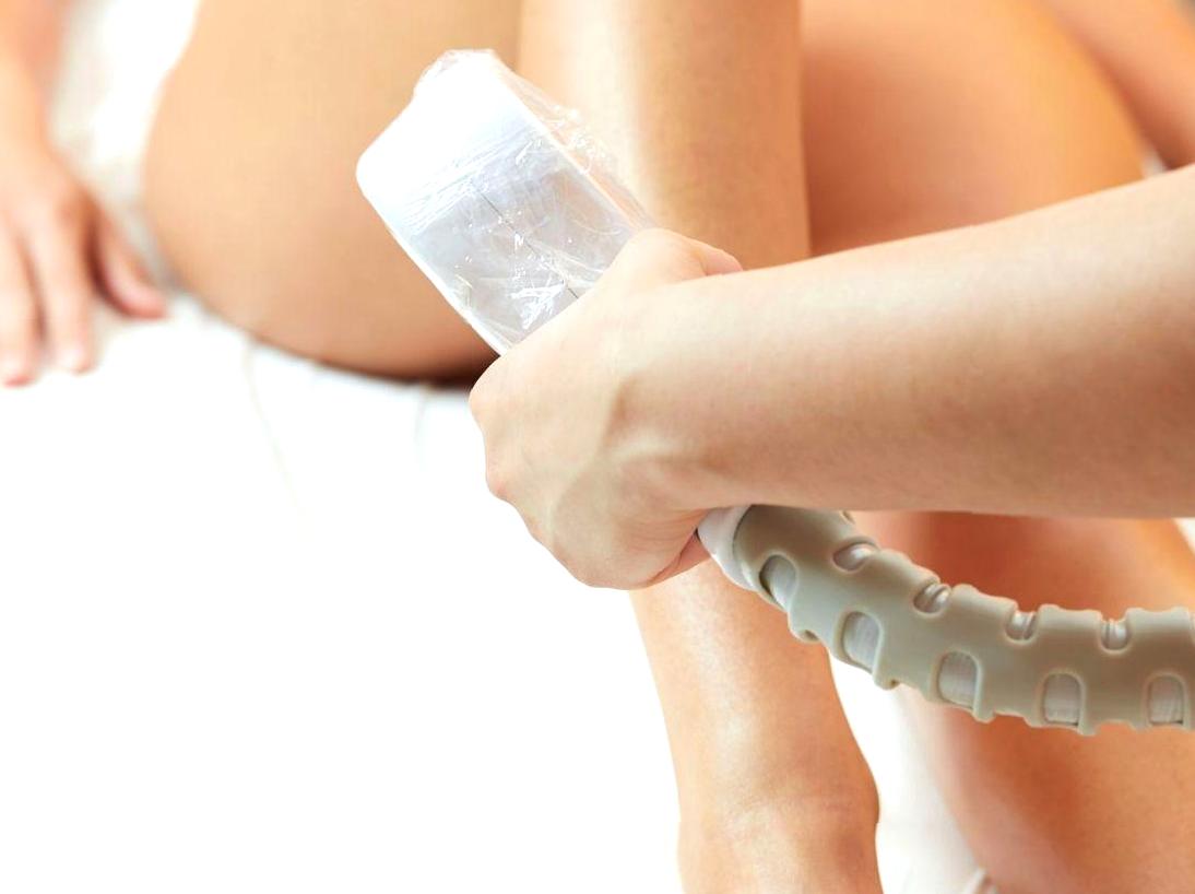 The Technology and Benefits of Laser Hair Removal