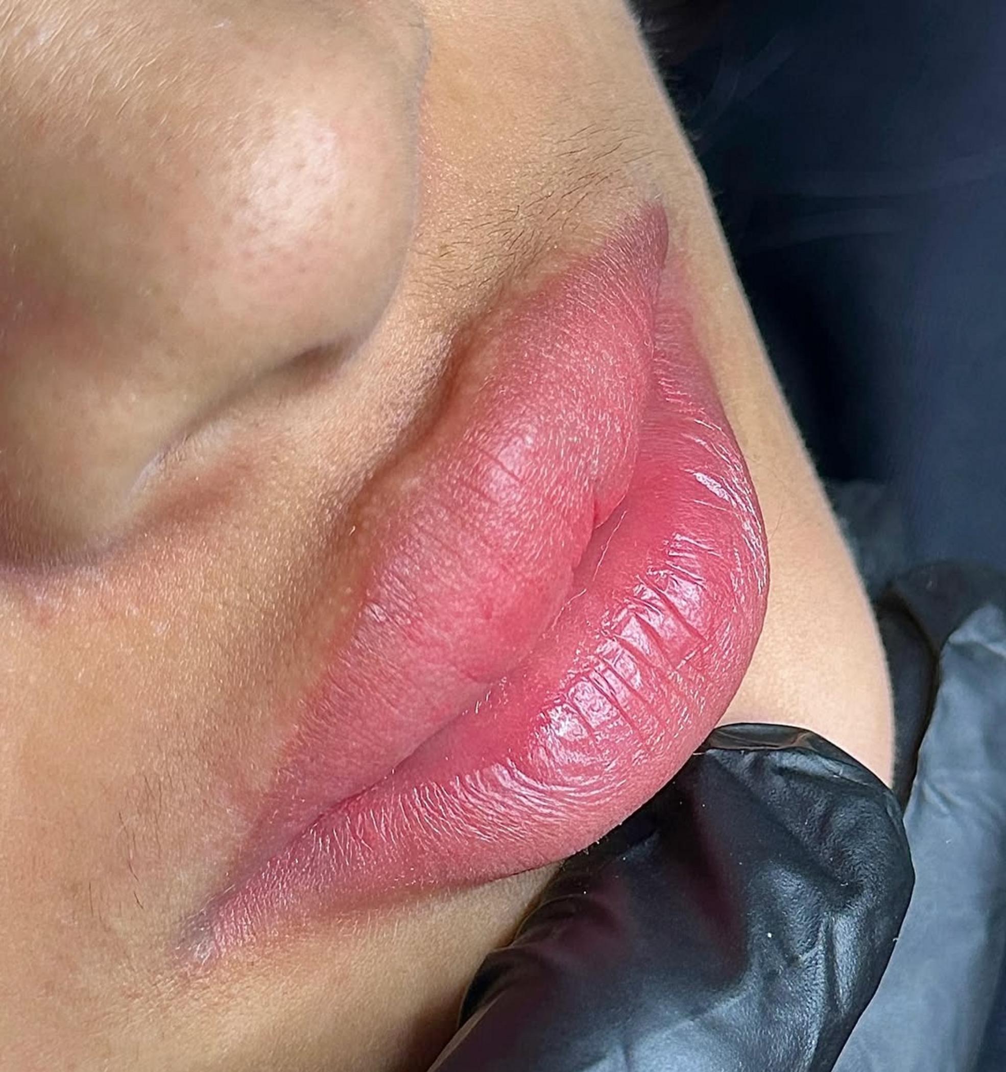 healing lip tattoo flaky skin close