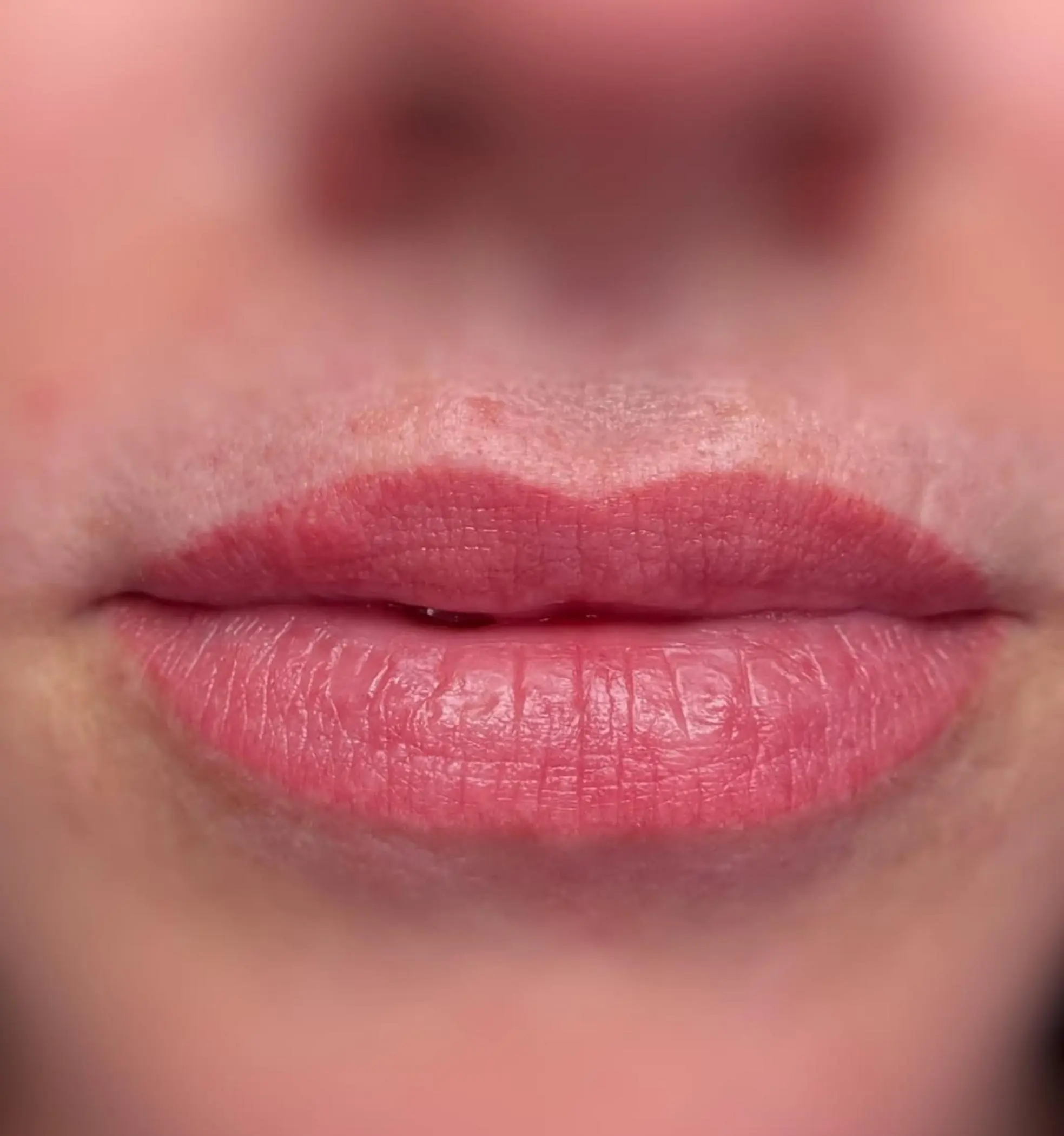 healing lips with slight flaking