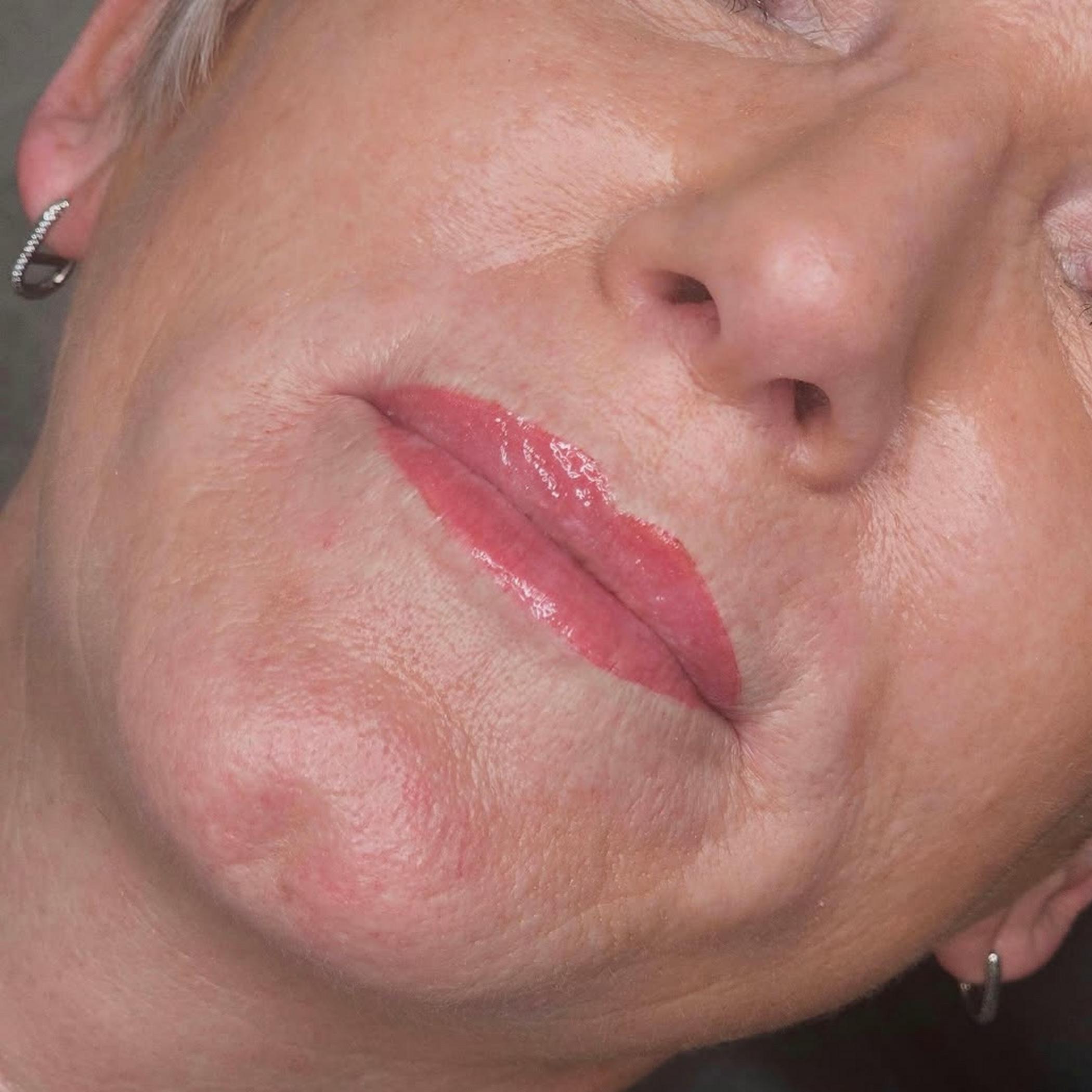 healing stage after lip blush treatment