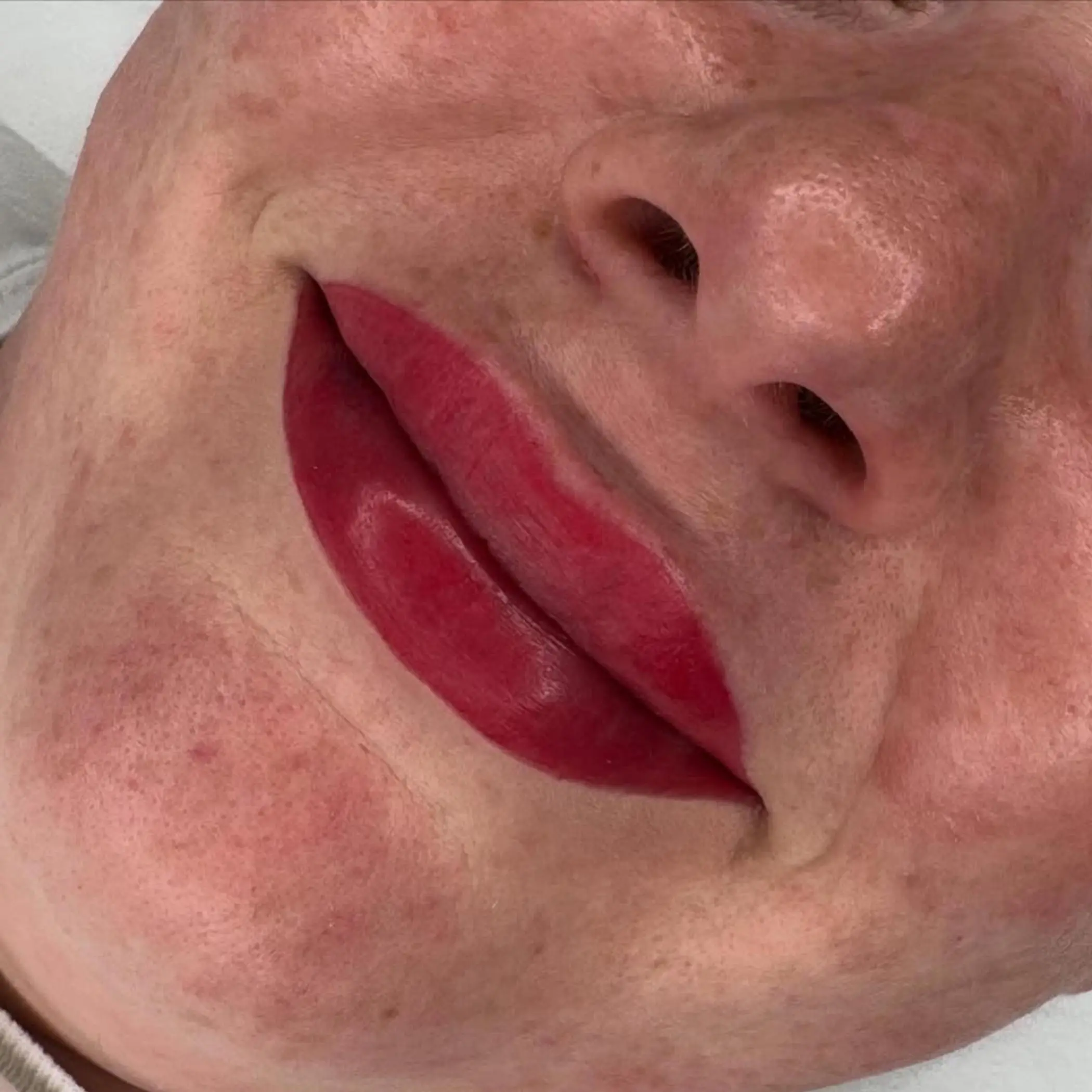 lip tattooing procedure in progress