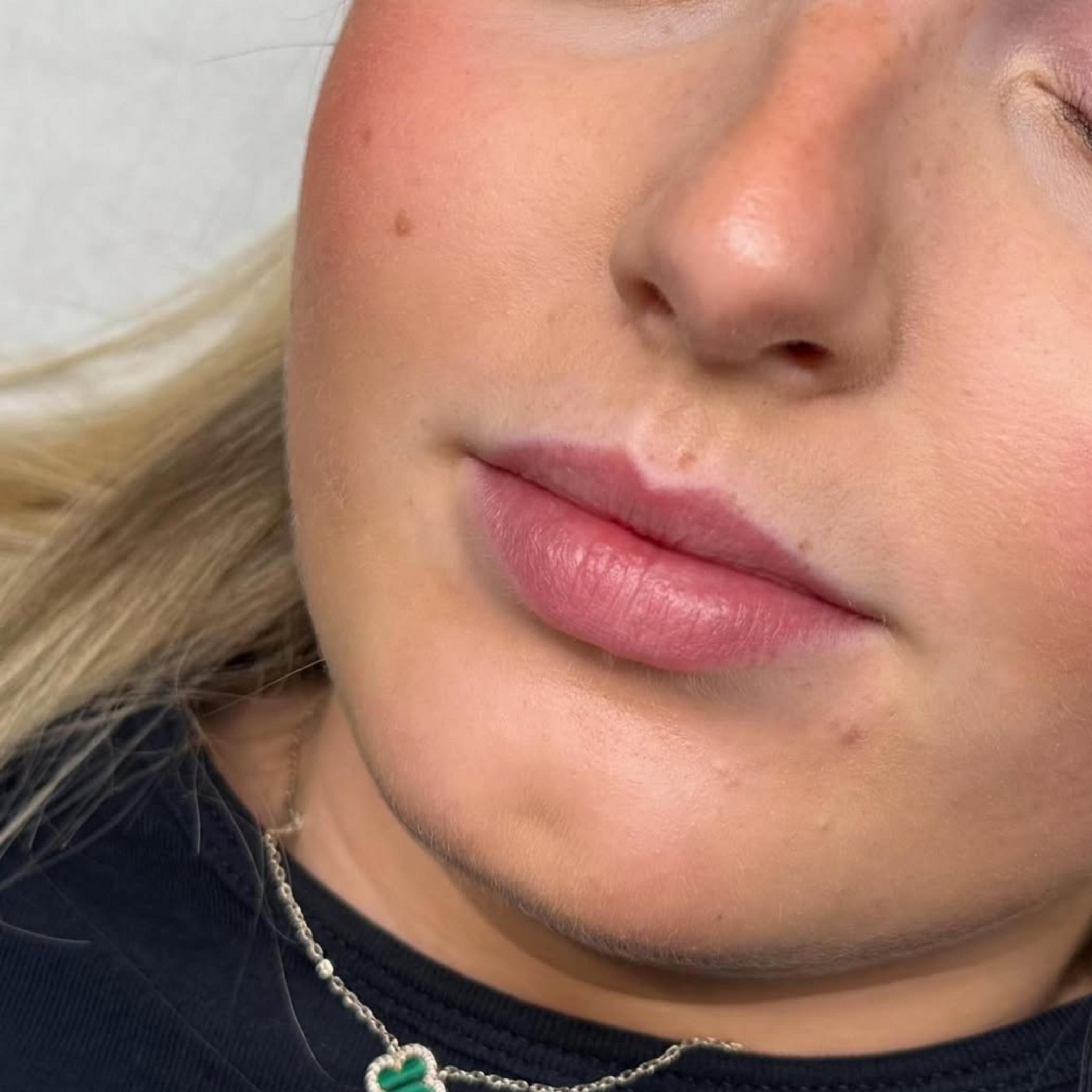 natural lip tattoo results on scar