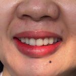 ombre lip tattoo before and after melanin rich