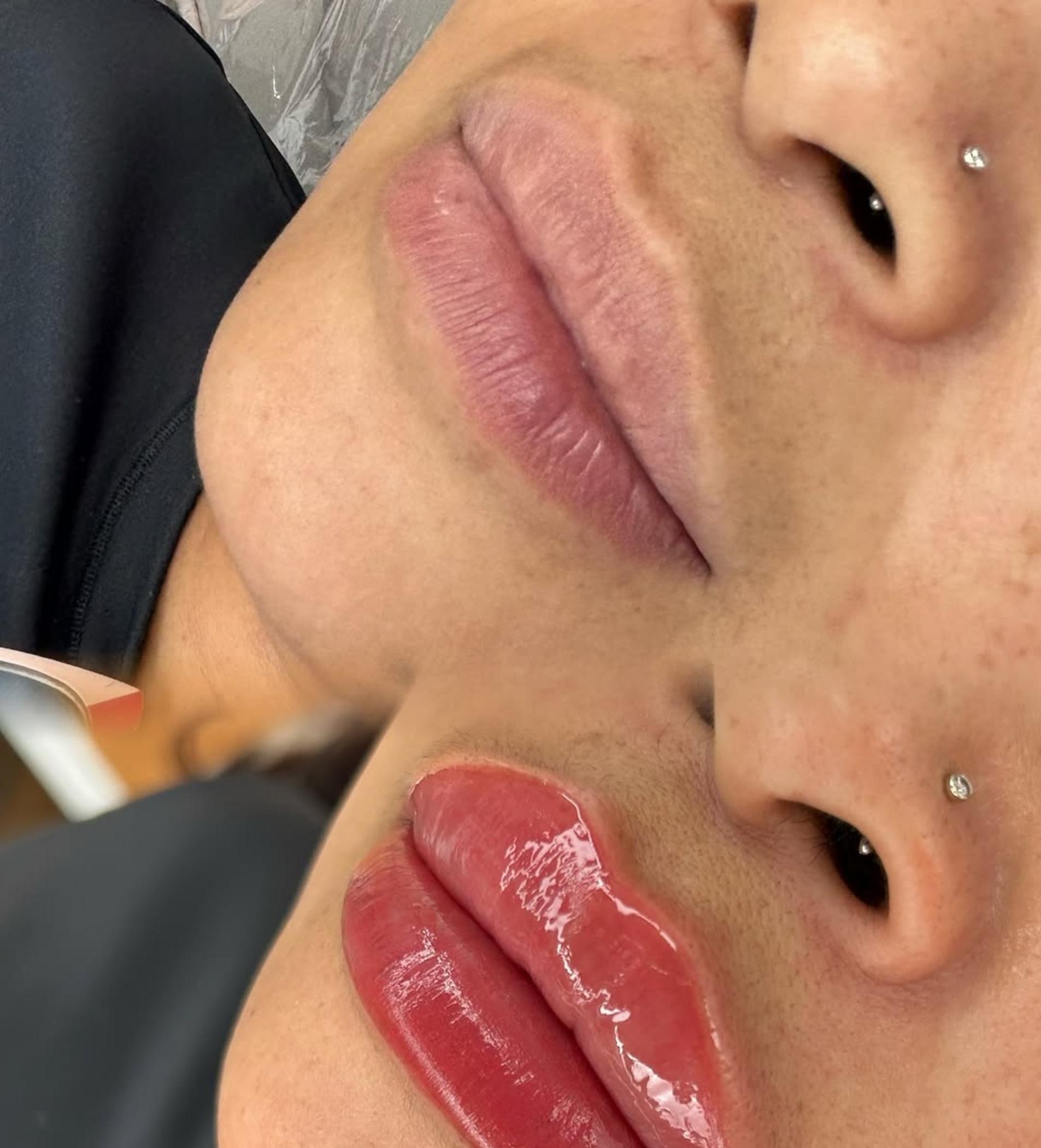 technician performing lip tattoo