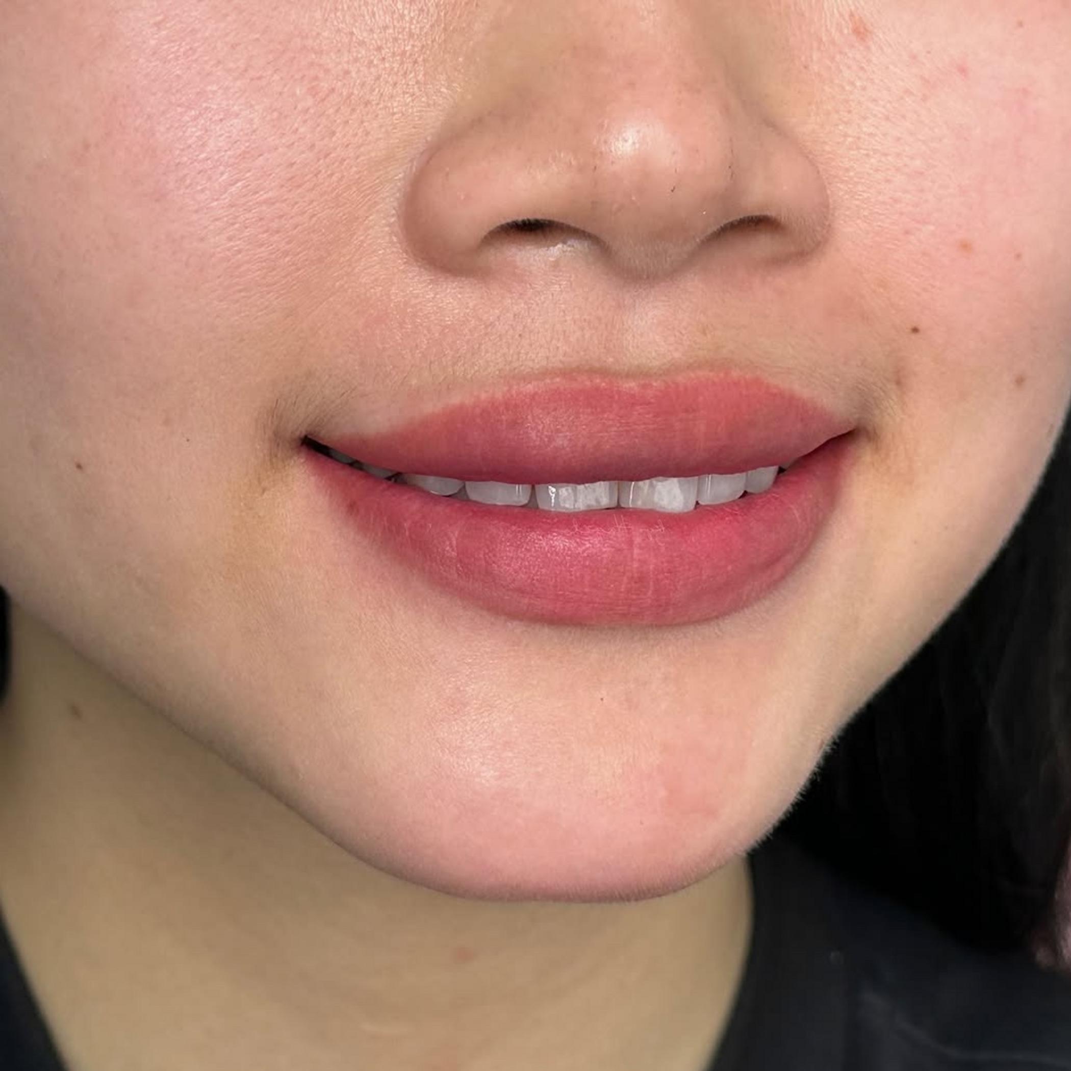 technician shaping lips with stencil